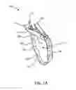 Fig. 02 - Ergonomic surgical instrument handle