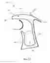 Fig. 16 - Ergonomic surgical instrument handle