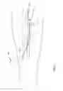 Fig. 03 - Preparation For Endovenous Laser Ablation