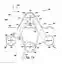Fig. 07 - Apparatus and methods for bone fracture fixation