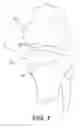 Fig. 02 - Method and Apparatus for Performing An Open Wedge Osteotomy
