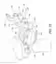 Fig. 30 - Method and Apparatus for Performing An Open Wedge Osteotomy
