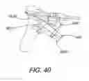 Fig. 49 - Method and Apparatus for Performing An Open Wedge Osteotomy
