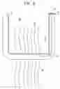 Fig. 08 - Floating gastrointestinal anchor