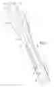 Fig. 08 - Systems and methods for minimally invasive surgical procedures