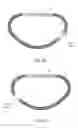 Fig. 07 - INDUCTION ACTIVATION OF ADJUSTABLE ANNULOPLASTY RINGS AND OTHER IMPLANTABLE DEVICES