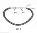 Fig. 09 - INDUCTION ACTIVATION OF ADJUSTABLE ANNULOPLASTY RINGS AND OTHER IMPLANTABLE DEVICES