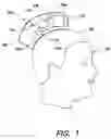 Fig. 02 - METHODS AND APPARATUS FOR CONFORMAL SENSING OF FORCE AND/OR ACCELERATION AT A PERSON'S HEAD