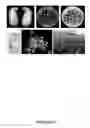 Fig. 136 - Manipulation of organic acid biosynthesis and secretion