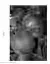 Fig. 04 - Nectarine tree named 'Nectarbondant'