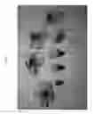 Fig. 02 - Peach tree named 'Flatbella'