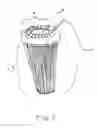 Fig. 02 - Plant protector cage