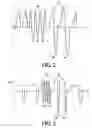 Fig. 03 - Insufflating-exsufflating system