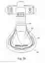 Fig. 22 - Respiratory mask assembly