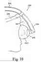 Fig. 37 - Respiratory mask assembly