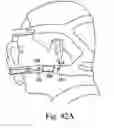 Fig. 40 - Respiratory mask assembly