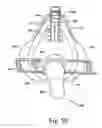 Fig. 46 - Respiratory mask assembly