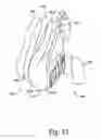 Fig. 47 - Respiratory mask assembly