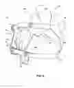 Fig. 07 - Chin strap
