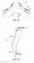 Fig. 46 - Cushion for a respiratory mask assembly