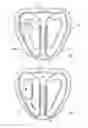 Fig. 02 - Human shoulder orthosis assist & method of use