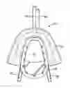 Fig. 01 - Methods and systems for improving airway patency