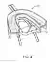 Fig. 08 - Methods and systems for improving airway patency