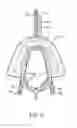 Fig. 09 - Methods and systems for improving airway patency