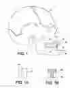Fig. 02 - MANDIBULAR ADVANCEMENT SPLINT