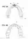 Fig. 04 - MANDIBULAR ADVANCEMENT SPLINT