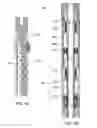 Fig. 06 - Section mill and method for abandoning a wellbore