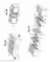 Fig. 03 - Programmable electrophoretic notch filter systems and methods
