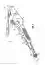 Fig. 02 - End-to end anastomosis instrument and method for performing same