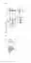 Fig. 03 - Paint spraying device for spraying various-colored paints
