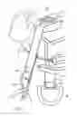 Fig. 20 - Skydiving equipment to distribute the tension forces of a drogue parachute