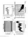 Fig. 04 - Methods, systems and computer program products for distributed scanning for motion artifact reduction in optical coherence tomography