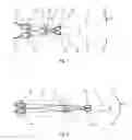 Fig. 02 - LASER ARRANGEMENT