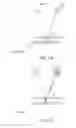 Fig. 03 - 3D mammography