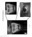 Fig. 50 - Method and apparatus for biometric data capture