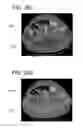 Fig. 35 - Hybrid segmentation of anatomical structure