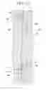 Fig. 28 - Light amount adjusting device and image capture apparatus