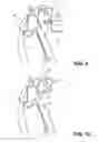 Fig. 05 - Cotter spring pin