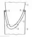 Fig. 01 - Arrangement and method to retrofit a wind turbine