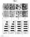 Fig. 02 - Therapeutic/prophylactic agent for prostate cancer