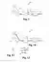 Fig. 09 - Flocked articles having a resistance to splitting and methods for making the same