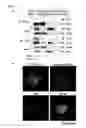 Fig. 02 - METHOD FOR DIAGNOSING NON-SMALL CELL LUNG CANCER