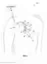 Fig. 02 - Lead integrity testing during suspected tachyarrhythmias