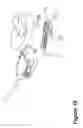 Fig. 19 - Infusion set of self-occlusion mechanism