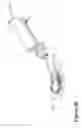 Fig. 29 - Infusion set of self-occlusion mechanism