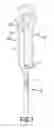 Fig. 02 - SAFETY NEEDLE CAP